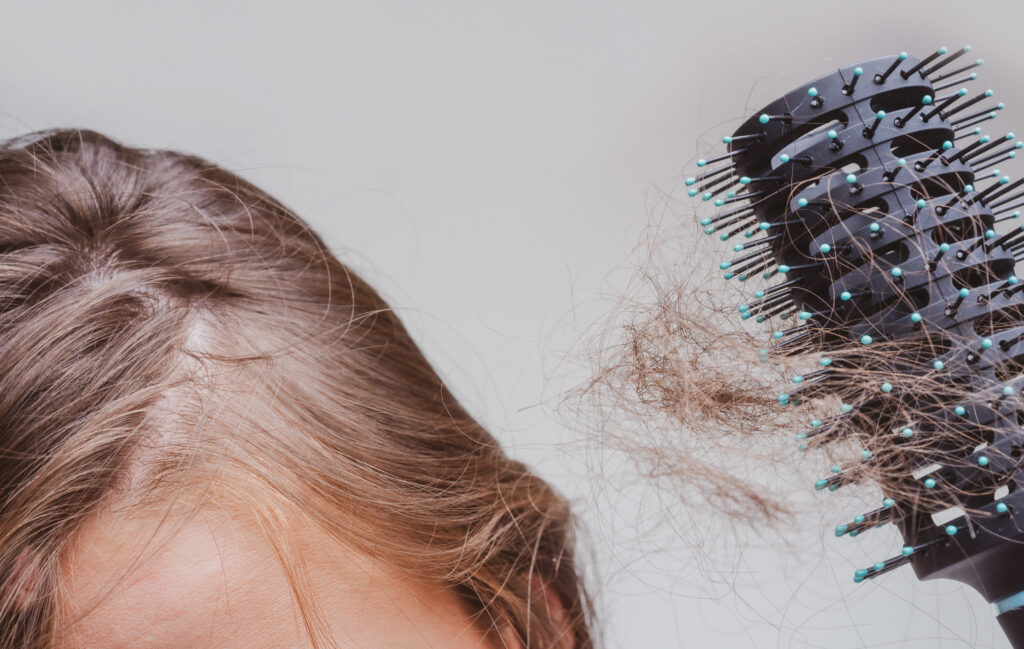 a que se debe la caida de cabello en mujeres
